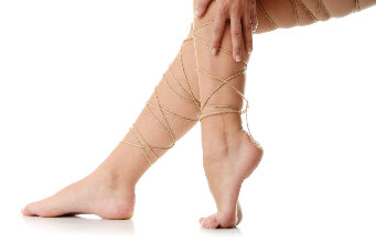 NanoVein helps with varicose veins of the legs