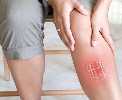 Functional disorder of venous blood flow in the lower link