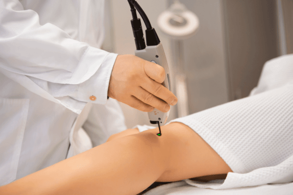 Laser correction for varicose veins