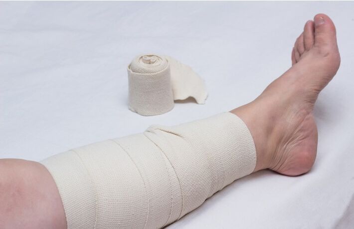 Compression bandage on the leg for varicose veins