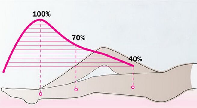 Scheme of the gradual decrease in pressure of compression clothing on legs affected by varicose veins