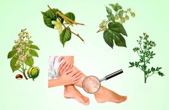 Herbs used to treat varicose veins in the legs