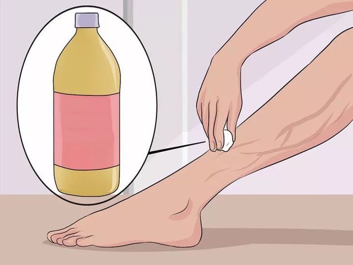 how to rub apple cider vinegar into the affected areas