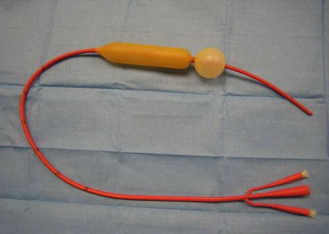Probe for varicose veins of the esophagus