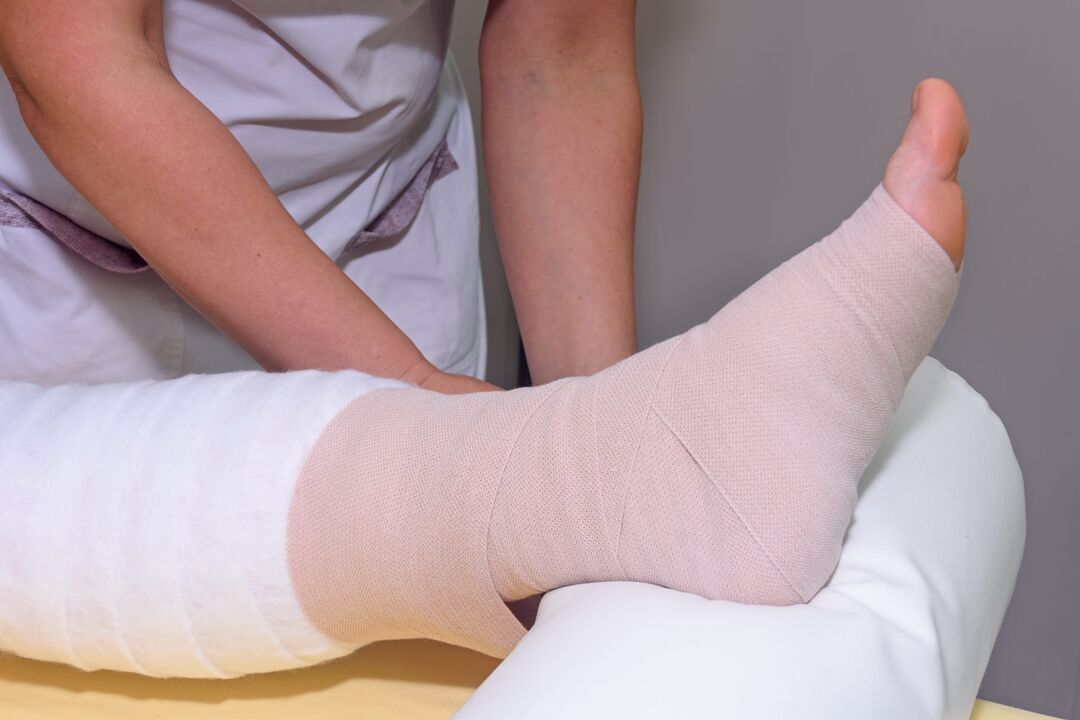 Elastic bandages for varicose veins in men