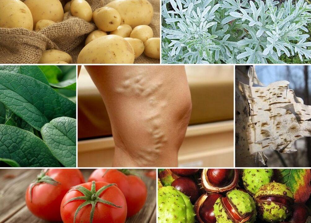 Folk remedies for varicose veins